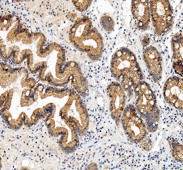 pb9185 gamma catenin primary antibodies ihc testing 1