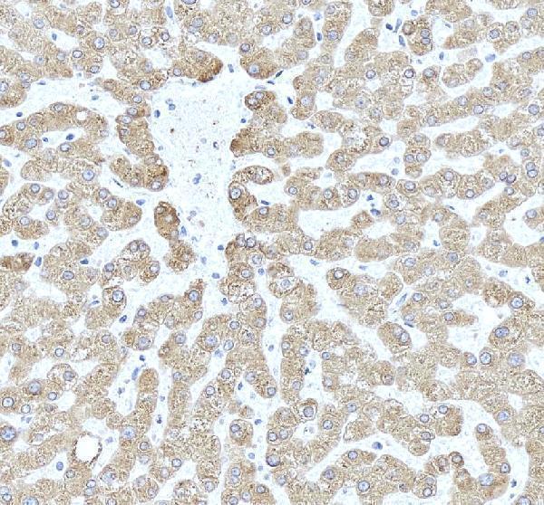 IHC analysis of CYP2E1 using anti-CYP2E1 antibody (PB9190)