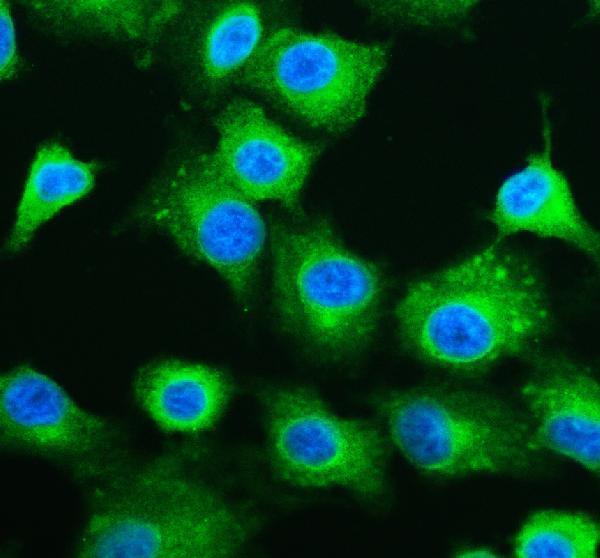 pb9198 g6pd primary antibodies if testing 1