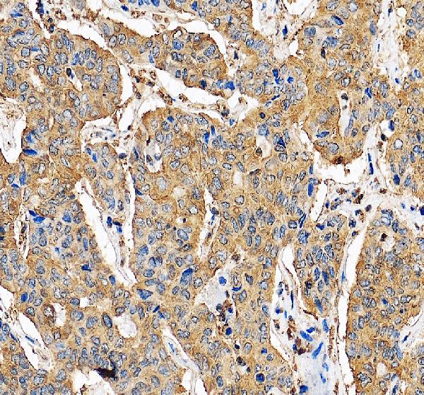 IHC analysis of G6PD using anti-G6PD antibody (PB9198)