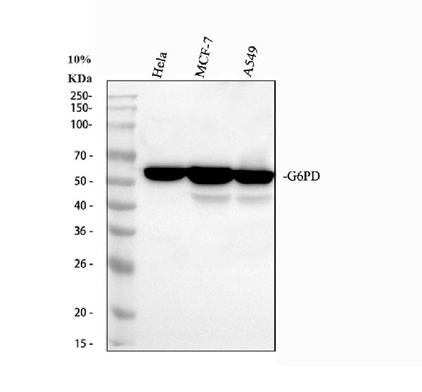 Western blot analysis of G6PD using anti-G6PD antibody (PB9198)