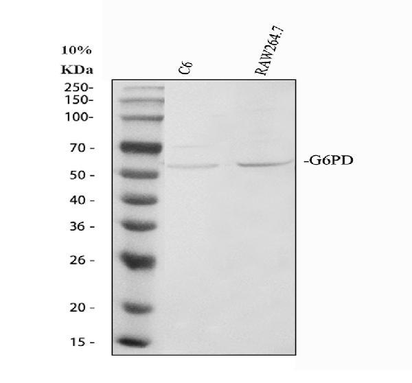 Western blot analysis of G6PD using anti-G6PD antibody (PB9198)