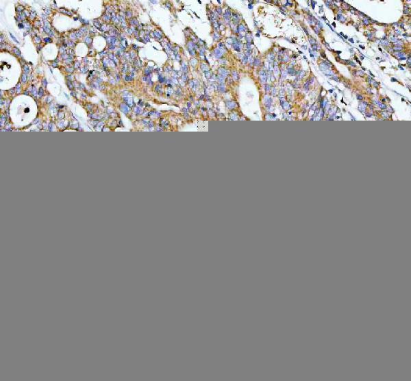 pb9201 gclc primary antibodies ihc testing 2