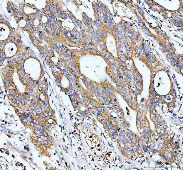 pb9201 gclc primary antibodies ihc testing 2_1