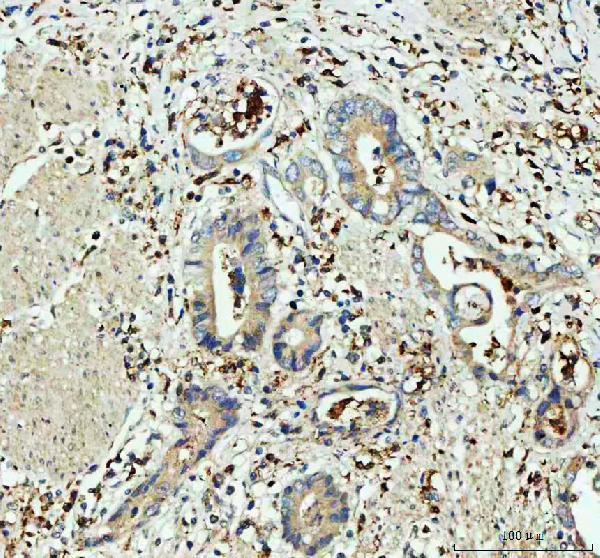 pb9203 gpx1 primary antibodies ihc testing 2