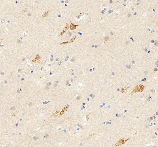 pb9204 gria1 primary antibodies ihc testing 7