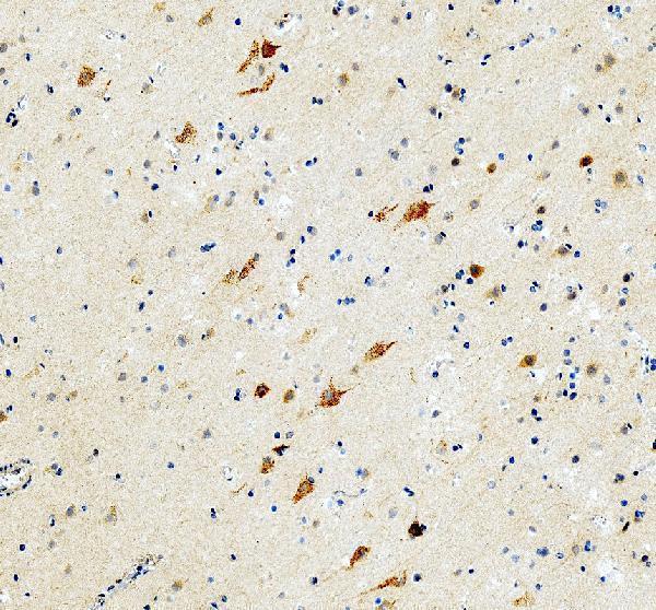 pb9204 slc6a1 primary antibodies ihc testing 6