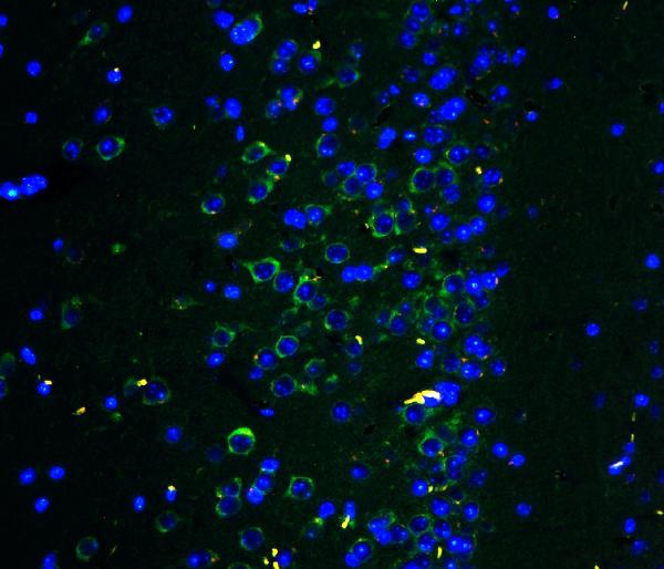 Figure 4. IF analysis of GRIA2 using anti-GRIA2 antibody (PB9205) GRIA2 was detected in paraffin-embedded section of mouse brain tissues. Heat mediated antigen retrieval was performed in citrate buffer (pH6, epitope retrieval solution ) for 20 mins. The tissue section was blocked with 10% goat serum. The tissue section was then incubated with 2microg/mL rabbit anti-GRIA2 Antibody (PB9205) overnight at 4°C. Biotin conjugated goat anti-rabbit IgG (BA1003) was used as secondary antibody and incubated for 30 minutes at 37°C. The tissue section was developed using DyLight?488 Conjugated Avidin (BA1128). The section was counterstained with DAPI. Visualize using a fluorescence microscope and filter sets appropriate for the label used. Figure 4. IF analysis of GRIA2 using anti-GRIA2 antibody (PB9205) GRIA2 was detected in paraffin-embedded section of mouse brain tissues. Heat mediated antigen retrieval was performed in citrate buffer (pH6, epitope retrieval solution ) for 20 mins. The tissue section was blocked with 10% goat serum. The tissue section was then incubated with 2microg/mL rabbit anti-GRIA2 Antibody (PB9205) overnight at 4°C. Biotin conjugated goat anti-rabbit IgG (BA1003) was used as secondary antibody and incubated for 30 minutes at 37°C. The tissue section was developed using DyLight?488 Conjugated Avidin (BA1128). The section was counterstained with DAPI. Visualize using a fluorescence microscope and filter sets appropriate for the label used.