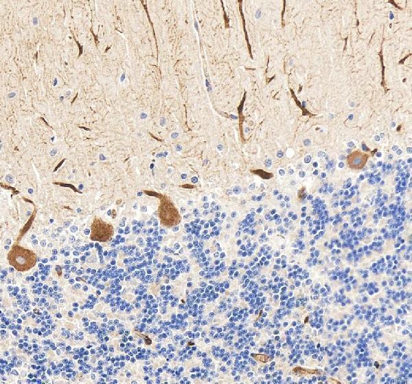 pb9205 gria2 primary antibodies ihc testing 4
