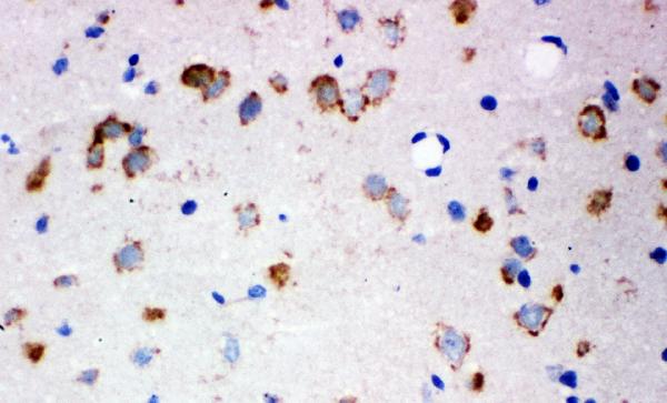 Figure 6. IHC analysis of GRIA2 using anti-GRIA2 antibody (PB9205). GRIA23 was detected in a frozen section of rat brain tissue. The tissue section was blocked with 10% goat serum. The tissue section was then incubated with 1 microg/ml rabbit anti-GRIA2 Antibody (PB9205) overnight at 4°C. Biotinylated goat anti-rabbit IgG was used as secondary antibody and incubated for 30 minutes at 37°C. The tissue section was developed using Strepavidin-Biotin-Complex (SABC) (Catalog # SA1022) with DAB as the chromogen. Figure 6. IHC analysis of GRIA2 using anti-GRIA2 antibody (PB9205). GRIA23 was detected in a frozen section of rat brain tissue. The tissue section was blocked with 10% goat serum. The tissue section was then incubated with 1 microg/ml rabbit anti-GRIA2 Antibody (PB9205) overnight at 4°C. Biotinylated goat anti-rabbit IgG was used as secondary antibody and incubated for 30 minutes at 37°C. The tissue section was developed using Strepavidin-Biotin-Complex (SABC) (Catalog # SA1022) with DAB as the chromogen.