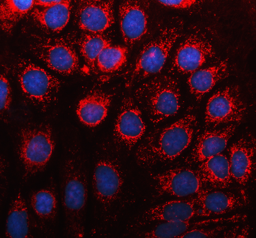 pb9211 hexb primary antibodies if testing 1