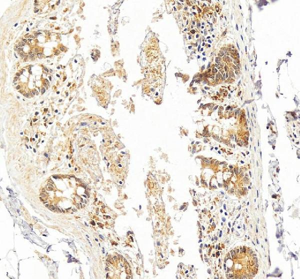 pb9212 hmox1 primary antibodies ihc testing 3