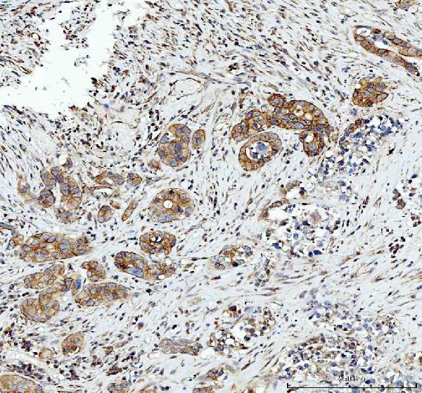 pb9213 hmox2 primary antibodies ihc testing 1