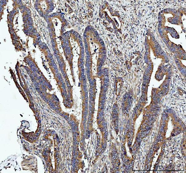 pb9213 hmox2 primary antibodies ihc testing 2