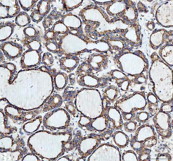 pb9213 hmox2 primary antibodies ihc testing 5