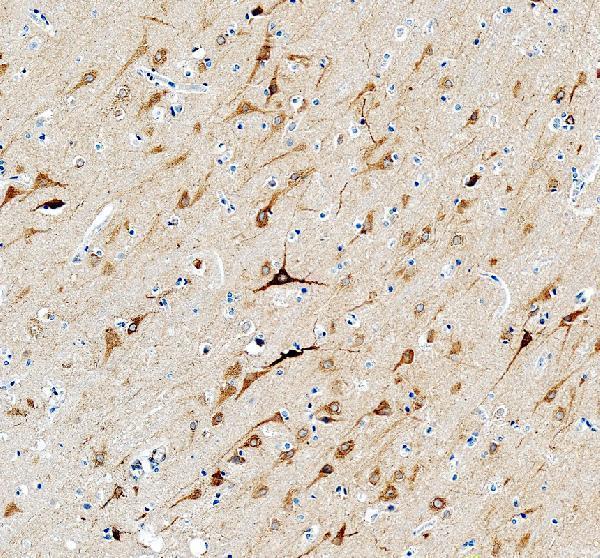 pb9225 itpr1 primary antibodies ihc testing 5