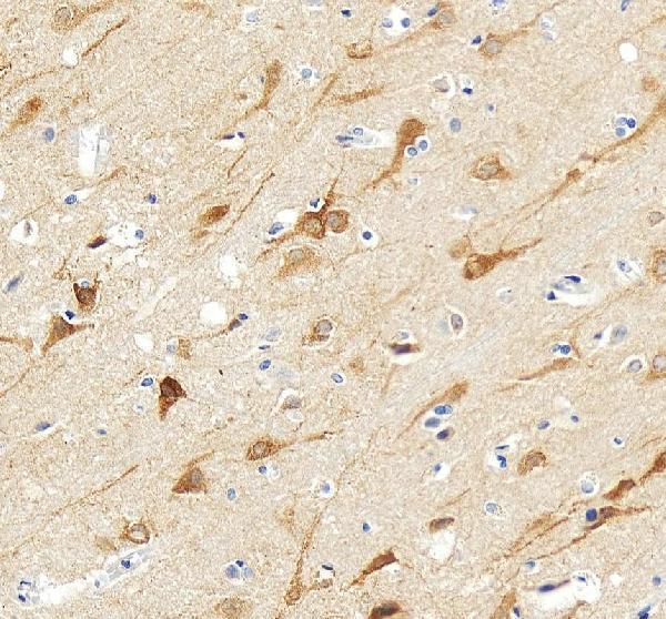 pb9225 itpr1 primary antibodies ihc testing 6