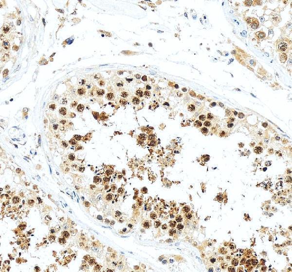 pb9230 kif2c primary antibodies ihc testing 6