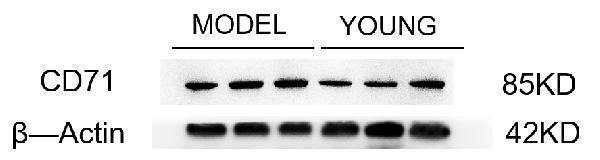 Western blot analysis of TFRC using anti-TFRC antibody (PB9233)