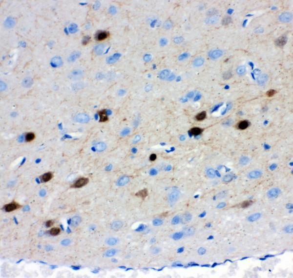 pb9248 3 ihc anti calretinin picoband antibody