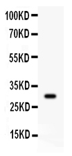 Western blot analysis of CD 8 alpha using anti-CD 8 alpha antibody (PB9249)