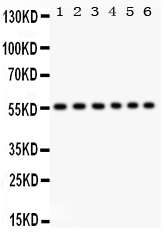 Western blot analysis of CD 8 alpha using anti-CD 8 alpha antibody (PB9249)