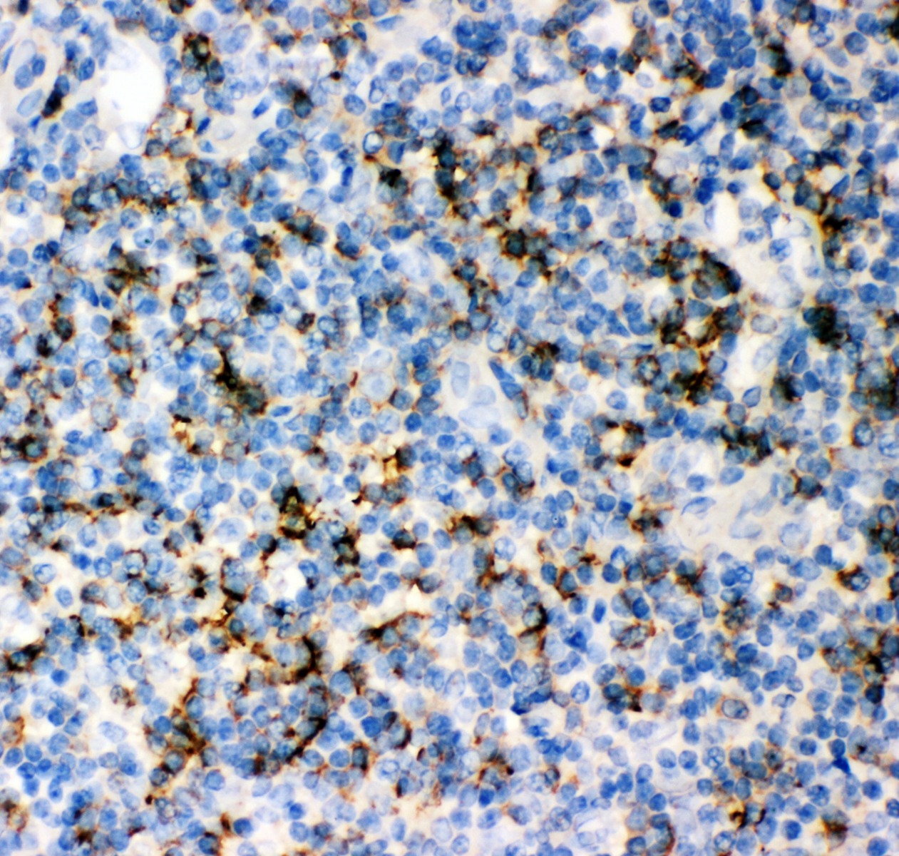 IHC analysis of CD 8 alpha using anti-CD 8 alpha antibody (PB9249)