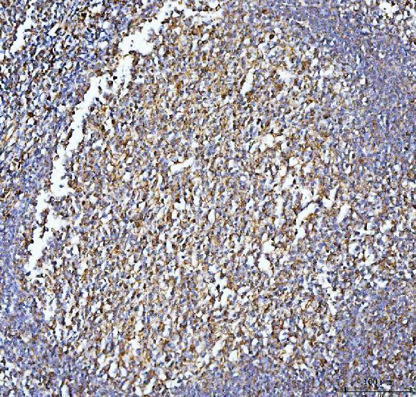  IHC analysis of CD86 using anti-CD86 antibody (PB9251)