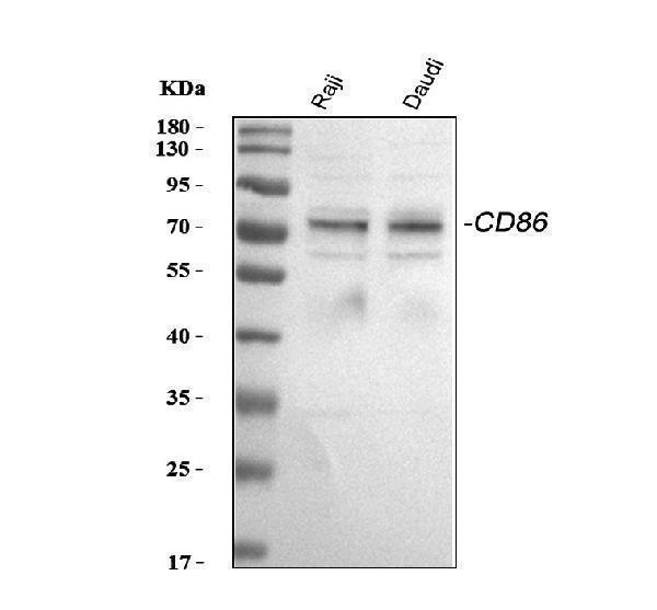 Western blot analysis of CD86 using anti-CD86 antibody (PB9251)