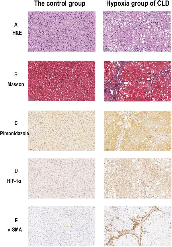 あ　H I F HIF-1-alpha/HIF1A Antibody