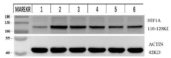 pb9253 hif1a primary antibodies wb testing 2