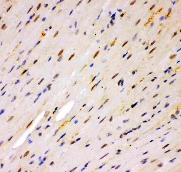 Figure 2. IHC analysis of MSK1 using anti-MSK1 antibody (PB9268). MSK1 was detected in a paraffin-embedded section of Mouse Cardiac Muscle tissue. Heat mediated antigen retrieval was performed in EDTA buffer (pH 8.0, epitope retrieval solution). The tissue section was blocked with 10% goat serum. The tissue section was then incubated with 1 microg/ml rabbit anti-MSK1 Antibody (PB9268) overnight at 4°C. Biotinylated goat anti-rabbit IgG was used as secondary antibody and incubated for 30 minutes at 37°C. The tissue section was developed using Strepavidin-Biotin-Complex (SABC) (Catalog # SA1022) with DAB as the chromogen.