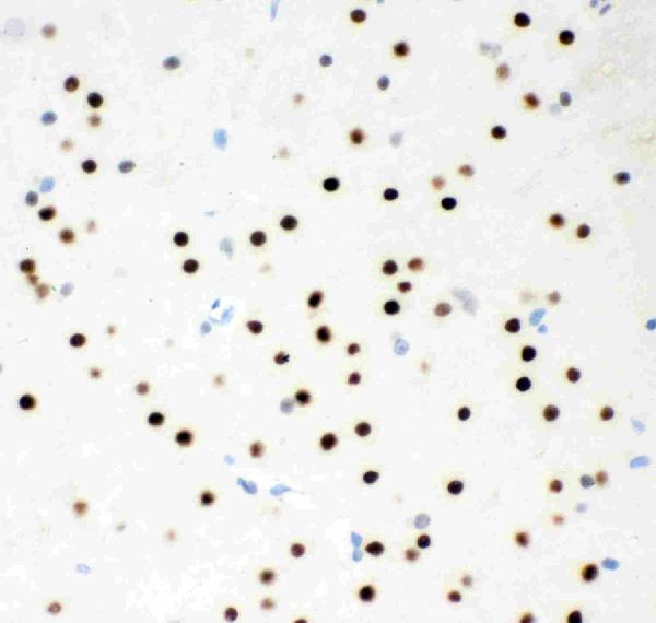 Figure 3. IHC analysis of MSK1 using anti-MSK1 antibody (PB9268). MSK1 was detected in a paraffin-embedded section of Rat Brain tissue. Heat mediated antigen retrieval was performed in EDTA buffer (pH 8.0, epitope retrieval solution). The tissue section was blocked with 10% goat serum. The tissue section was then incubated with 1 microg/ml rabbit anti-MSK1 Antibody (PB9268) overnight at 4°C. Biotinylated goat anti-rabbit IgG was used as secondary antibody and incubated for 30 minutes at 37°C. The tissue section was developed using Strepavidin-Biotin-Complex (SABC) (Catalog # SA1022) with DAB as the chromogen.