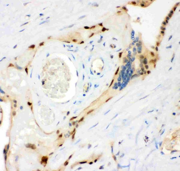 Figure 4. IHC analysis of MSK1 using anti-MSK1 antibody (PB9268). MSK1 was detected in a paraffin-embedded section of Human Placenta tissue. Heat mediated antigen retrieval was performed in EDTA buffer (pH 8.0, epitope retrieval solution). The tissue section was blocked with 10% goat serum. The tissue section was then incubated with 1 microg/ml rabbit anti-MSK1 Antibody (PB9268) overnight at 4°C. Biotinylated goat anti-rabbit IgG was used as secondary antibody and incubated for 30 minutes at 37°C. The tissue section was developed using Strepavidin-Biotin-Complex (SABC) (Catalog # SA1022) with DAB as the chromogen.