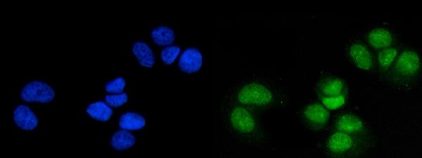 Figure 5. IF analysis of MSK1 using anti-MSK1 antibody (PB9268). MSK1 was detected in an immunocytochemical section of T47D cells. Enzyme antigen retrieval was performed using IHC enzyme antigen retrieval reagent (AR0022) for 15 mins. The cells were blocked with 10% goat serum. And then incubated with 5 microg/mL rabbit anti-MSK1 Antibody (PB9268) overnight at 4°C. DyLight®488 Conjugated Goat Anti-Rabbit IgG (BA1127) was used as secondary antibody at 1:500 dilution and incubated for 30 minutes at 37°C. The section was counterstained with DAPI. Visualize using a fluorescence microscope and filter sets appropriate for the label used.
