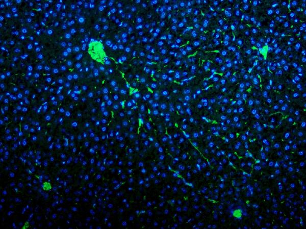 Figure 5. IF analysis of VWF using anti-VWF antibody (PB9273). VWF was detected in paraffin-embedded section of rat liver tissue. Heat mediated antigen retrieval was performed in EDTA buffer (pH8.0, epitope retrieval solution). The tissue section was blocked with 10% goat serum. The tissue section was then incubated with 2microg/mL rabbit anti-VWF Antibody (PB9273) overnight at 4°C. DyLight®488 Conjugated Goat Anti-Rabbit IgG (BA1127) was used as secondary antibody at 1:100 dilution and incubated for 30 minutes at 37°C. The section was counterstained with DAPI. Visualize using a fluorescence microscope and filter sets appropriate for the label used.