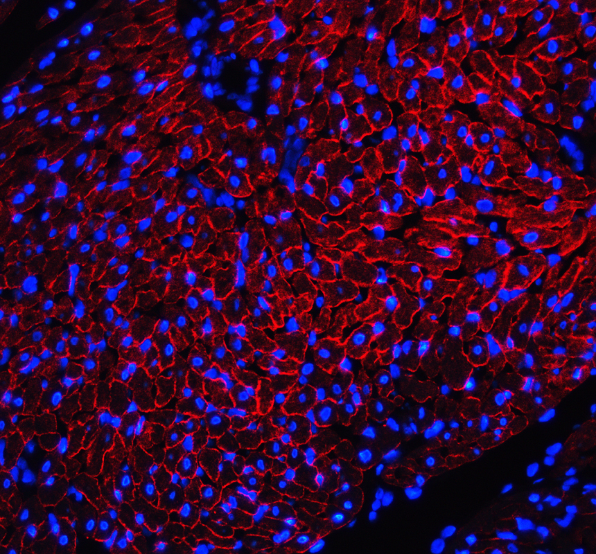 pb9276 dmd primary antibodies if testing 1