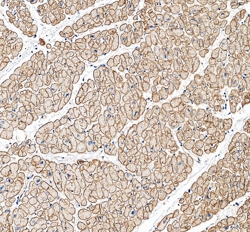 IHC analysis of Dystrophin/DMD using anti-Dystrophin/DMD antibody (PB9276)