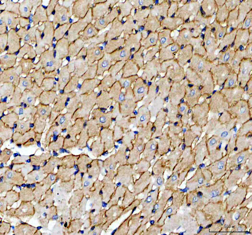 IHC analysis of Dystrophin/DMD using anti-Dystrophin/DMD antibody (PB9276)