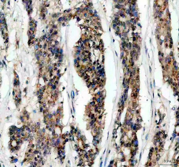 pb9292 ikb beta primary antibodies ihc testing 1