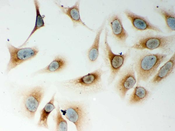 pb9294 card4_ primary antibodies ihc testing 4