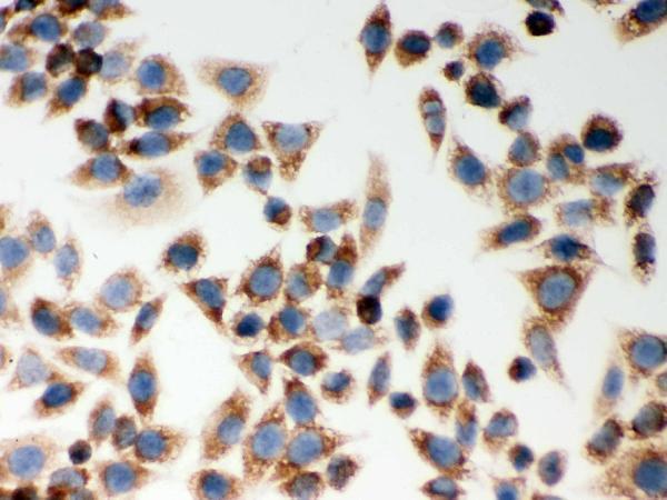 pb9294 card4_ primary antibodies ihc testing 5