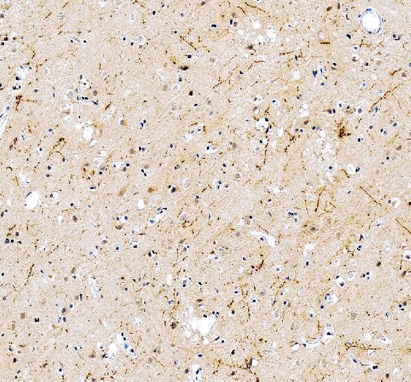 pb9296 npy primary antibodies ihc testing 4