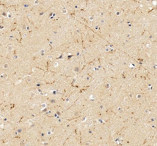 pb9296 npy primary antibodies ihc testing 5