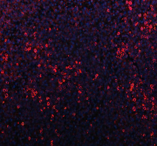 pb9305 p2x5 primary antibodies if testing 1