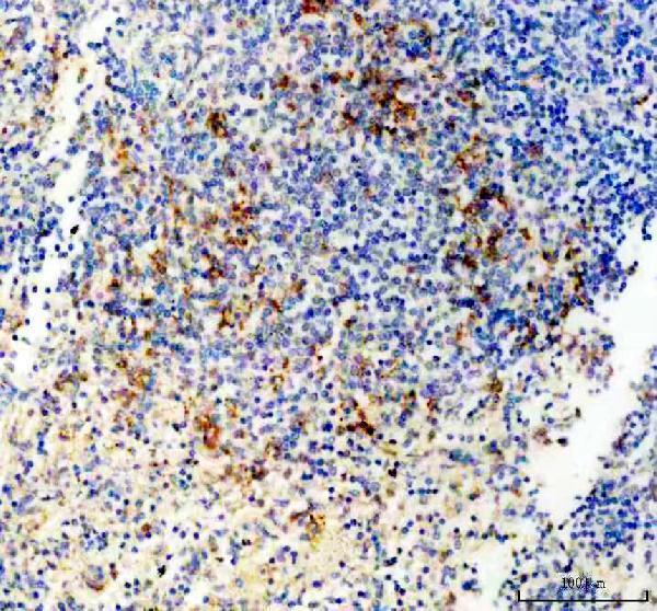 pb9305 p2x5 primary antibodies ihc testing 1