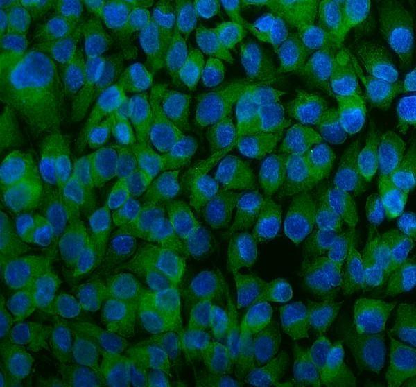 pb9308 park7 primary antibodies if testing 1
