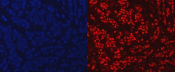 pb9309 parp primary antibodies if testing 18