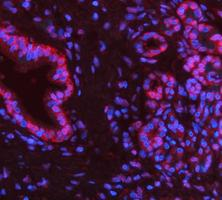 pb9309 parp1 primary antibodies if testing 16