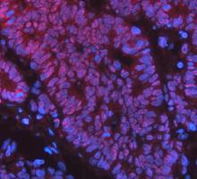 pb9309 parp1 primary antibodies if testing 17
